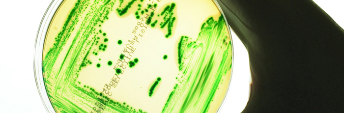 Listeria growing on agar plate